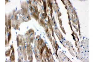 Immunohistochemistry (IHC) image for anti-Voltage-Dependent Anion Channel 1 (VDAC1) (AA 154-181), (Middle Region) antibody (ABIN3043959)