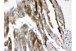 Anti-VDAC Picoband antibody, IHC(P) IHC(P): Mouse Cardiac Muscle Tissue (VDAC1 抗体  (Middle Region))