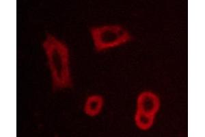 ABIN6267260 staining BT-20 cells by ICC/IF. (EGFR 抗体  (pTyr1016))