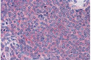 Human Spleen (formalin-fixed, paraffin-embedded) stained with LY75 antibody ABIN337388 at 10 ug/ml followed by biotinylated goat anti-rabbit IgG secondary antibody ABIN481713, alkaline phosphatase-streptavidin and chromogen. (LY75/DEC-205 抗体  (C-Term))
