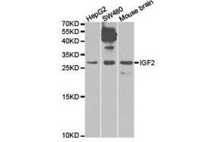 Western Blotting (WB) image for anti-Insulin-Like Growth Factor 2 (IGF2) antibody (ABIN1873163) (IGF2 抗体)