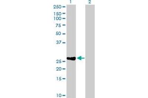 Western Blot analysis of DIRAS2 expression in transfected 293T cell line by DIRAS2 MaxPab polyclonal antibody. (DIRAS2 抗体  (AA 1-199))