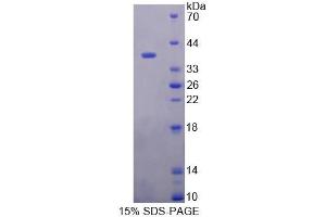 SDS-PAGE analysis of Human PTTG1IP Protein. (PTTG1IP 蛋白)
