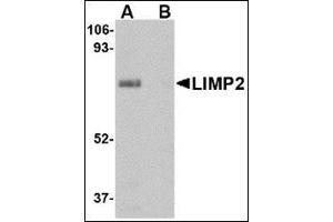 Western blot analysis of LIMP2 in human skeletal muscle tissue lysate with this product at 1 μg/ml in (A) the absence and (B) presence of blocking peptide. (SCARB2 抗体  (Center))