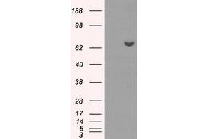 HEK293T cells were transfected with the pCMV6-ENTRY control (Left lane) or pCMV6-ENTRY HDAC10 (Right lane) cDNA for 48 hrs and lysed. (HDAC10 抗体)