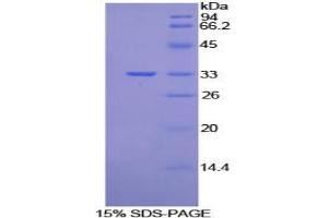 SDS-PAGE analysis of Mouse Vang Like Protein 1 Protein. (Vangl1 蛋白)