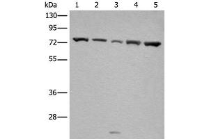 Western blot analysis of Hela and A431 cell Mouse brain tissue HT-29 and Jurkat cell lysates using GARS Polyclonal Antibody at dilution of 1:540 (GARS 抗体)