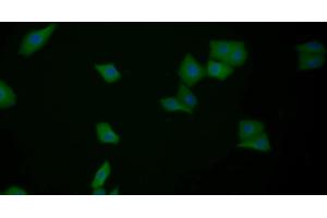 Detection of GAL3 in Human MCF7 cell using Polyclonal Antibody to Galectin 3 (GAL3) (Galectin 3 抗体  (AA 1-250))