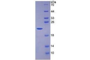 Image no. 3 for Interleukin 7 (IL7) (AA 26-177) (Active) protein (His tag) (ABIN6239759) (IL-7 Protein (AA 26-177) (His tag))