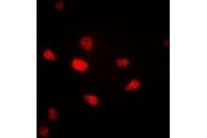Immunofluorescent analysis of Progesterone Receptor staining in A549 cells. (Progesterone Receptor 抗体)