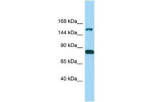 Host: Rabbit Target Name: IQSEC2 Sample Type: MDA-MB-435S Whole Cell lysates Antibody Dilution: 1. (IQSEC2 抗体  (Middle Region))