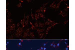 Immunofluorescence (IF) image for anti-Guanine Nucleotide Binding Protein (G Protein), alpha Inhibiting Activity Polypeptide 2 (GNAI2) antibody (ABIN7257946)