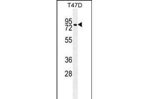 ZNF69 Antibody (C-term) (ABIN655666 and ABIN2845136) western blot analysis in T47D cell line lysates (35 μg/lane). (ZFP69 抗体  (C-Term))