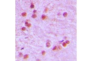 Immunohistochemical analysis of FOXR1 staining in human brain formalin fixed paraffin embedded tissue section. (FOXR1 抗体  (C-Term))