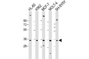 All lanes : Anti-PIGC Antibody (Center) at 1:2000 dilution Lane 1: HL-60 whole cell lysate Lane 2: K562 whole cell lysate Lane 3: MCF-7 whole cell lysate Lane 4: MOLT-4 whole cell lysate Lane 5: SH-SY5Y whole cell lysate Lysates/proteins at 20 μg per lane. (PIGC 抗体  (AA 81-112))