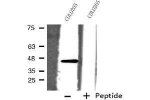 Western blot analysis of extracts from COLO205 cells, using ORCTL-2 antibody. (ORCTL-2/SLC22A18 抗体  (C-Term))
