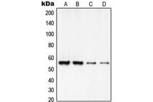 Western blot analysis of RCC2 expression in HeLa (A), A549 (B), MOLT4 (C), NIH3T3 (D) whole cell lysates. (RCC2 抗体  (C-Term))