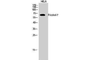 Western Blotting (WB) image for anti-Frizzled Family Receptor 7 (FZD7) (N-Term) antibody (ABIN3175159) (FZD7 抗体  (N-Term))