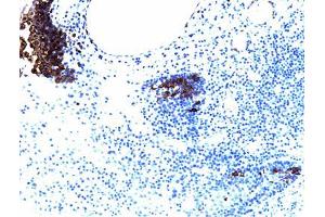 PDGFRbeta (pY857) staining on tonsil. (PDGFRB 抗体  (pTyr857))