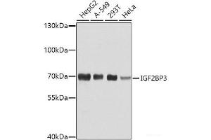 Western blot analysis of extracts of various cell lines using IGF2BP3 Polyclonal Antibody at dilution of 1:1000. (IGF2BP3 抗体)