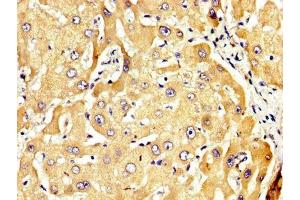 IHC image of ABIN7167891 diluted at 1:300 and staining in paraffin-embedded human liver tissue performed on a Leica BondTM system. (RECK 抗体  (AA 23-212))
