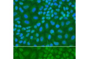 Immunofluorescence analysis of A549 cells using TDG Polyclonal Antibody (TDG 抗体)