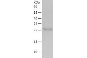 Western Blotting (WB) image for Methylmalonic Aciduria (Cobalamin Deficiency) CblC Type, with Homocystinuria (MMACHC) (AA 1-282) protein (His tag) (ABIN7123941) (MMACHC Protein (AA 1-282) (His tag))