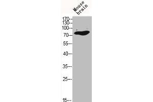 Western Blot analysis of MOUSE-BRAIN cells using C-TAK1 Polyclonal Antibody (MARK3 抗体  (N-Term))