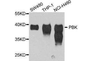 Western blot analysis of extracts of various cell lines, using PBK antibody (ABIN5995492) at 1/1000 dilution. (Symplekin 抗体)