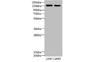 Western blot All lanes: TPP2antibody at 3. (Tpp2 抗体  (AA 1-300))