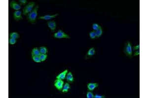 Immunofluorescent analysis of PC-3 cells using ABIN7173103 at dilution of 1:100 and Alexa Fluor 488-congugated AffiniPure Goat Anti-Rabbit IgG(H+L) (TMEM177 抗体  (AA 219-311))