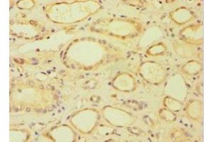 Immunohistochemistry of paraffin-embedded human kidney tissue using ABIN7158678 at dilution of 1:100 (BRCC3 抗体  (AA 1-316))