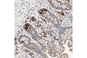 Immunohistochemical staining of human colon with KBTBD5 polyclonal antibody  shows strong positivity in Paneth cells.