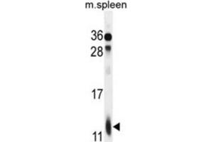 Western Blotting (WB) image for anti-Ribosomal Protein L39 (RPL39) antibody (ABIN2996042) (RPL39 抗体)