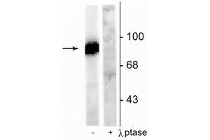 Western blot of rat hippocampal lysate stimulated with forskolin showing specific immunolabeling of the ~95 kDa dynamin phosphorylated at Ser778 in the first lane (-). (Dynamin 1 抗体  (pSer778))