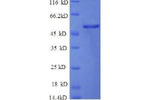 SDS-PAGE (SDS) image for Enolase 1 (ENO1) (AA 2-433), (partial) protein (His tag) (ABIN7478975)