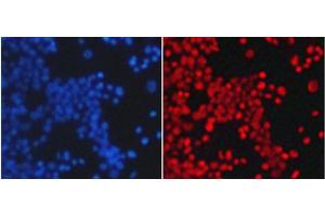 Immunofluorescence analysis of 293T cells using TriMethyl-Histone H4-K20 Polyclonal Antibody (Histone H4 抗体  (3meLys20))