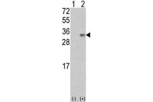 Western blot analysis of VEGFB antibody and 293 cell lysate (2 ug/lane) either nontransfected (Lane 1) or transiently transfected with the VEGF2/VEGFB gene (2). (VEGFB (VEGF2) (AA 110-139) 抗体)
