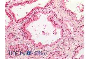 ABIN334503 (5µg/ml) staining of paraffin embedded Human Prostate. (TARDBP 抗体  (Internal Region))