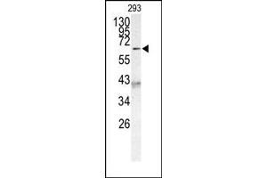 Image no. 1 for anti-Protein AF-9 (MLLT3) (C-Term) antibody (ABIN358673)