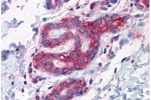 Human Breast: Formalin-Fixed, Paraffin-Embedded (FFPE) (G3BP1 抗体  (AA 214-303))