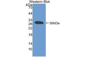 Western Blotting (WB) image for anti-ATP-Binding Cassette, Sub-Family B (MDR/TAP), Member 11 (ABCB11) (AA 420-656) antibody (ABIN1980368)