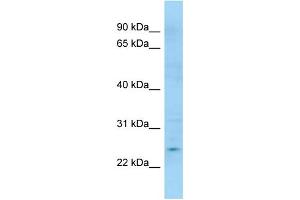 WB Suggested Anti-APOBEC3H Antibody Titration: 1. (APOBEC3H 抗体  (C-Term))