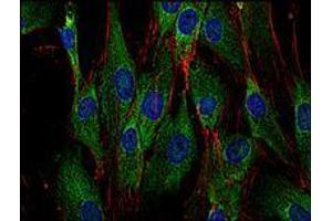 Immunofluorescence (IF) image for anti-Son of Sevenless Homolog 1 (SOS1) antibody (ABIN238504) (SOS1 抗体)