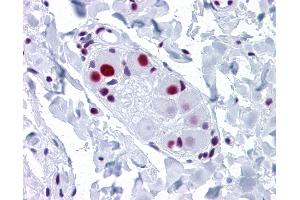 Anti-SNRPA antibody IHC of human small intestine, submucosal plexus. (SNRPA1 抗体  (AA 1-283))