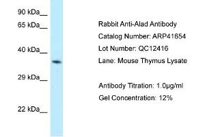 Host: Rabbit Target Name: ALAD Sample Tissue: Mouse Thymus Antibody Dilution: 1ug/ml (ALAD 抗体  (N-Term))