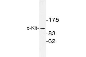 Western blot with extracts from A549 cells using c-Kit antibody . (KIT 抗体)