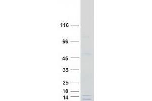 Western Blotting (WB) image for Glutamyl-tRNA Amidotransferase, Subunit C (GATC) protein (Myc-DYKDDDDK Tag) (ABIN2721742)