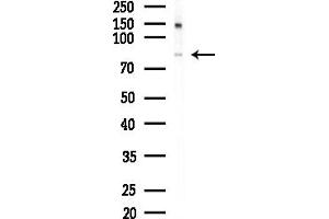 anti-FAST Kinase Domains 2 (FASTKD2) (Internal Region) antibody