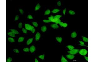 Immunofluorescence of purified MaxPab antibody to LOXL1 on HeLa cell. (LOXL1 抗体  (AA 1-574))